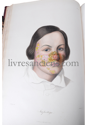 Photo CAZENAVE, Pierre-Louis Alphée. 