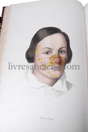 Photo CAZENAVE, Pierre-Louis Alphée.