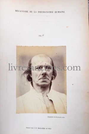 Photo DUCHENNE, Guillaume-Benjamin. 